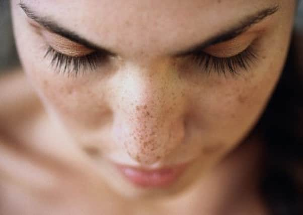 A few ferntickles on a lassie's nose. Picture: Getty