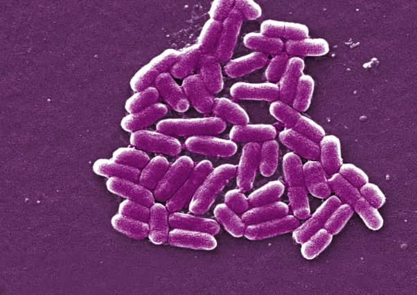 The E.coli bug.