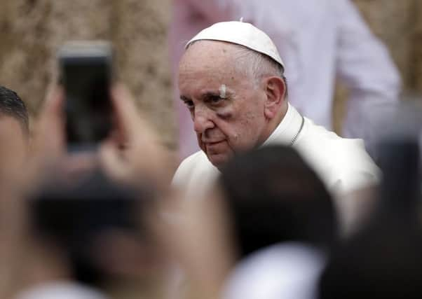 Pope Francis suffered a bruise to his cheek after falling in his Popemobile in Cartagena, Colombia. Picture: AP