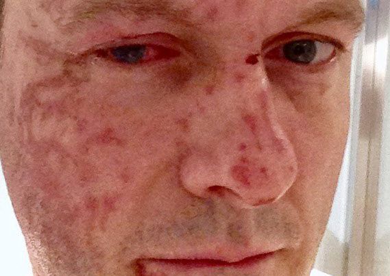 Journalist reveals all about doorstep acid attack in new book